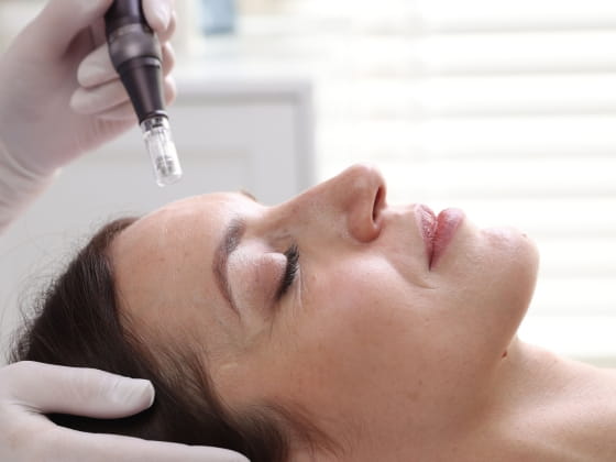 Beyond-the-Treatment-Why-Aesthetic-Procedures-Need-Microbiome-Support-Esse-Microbiome-Skincare-Mar2026-Blog-Banner